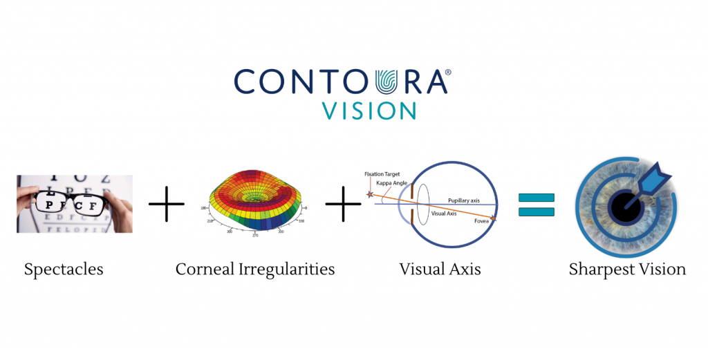 Contoura Vision